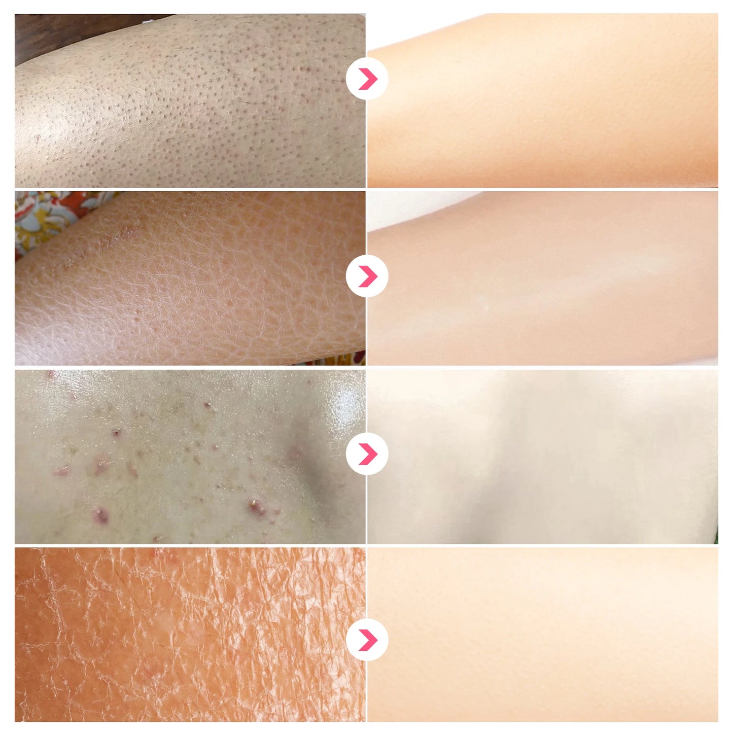 KP Repair Body Cream β Smooth & Moisturize