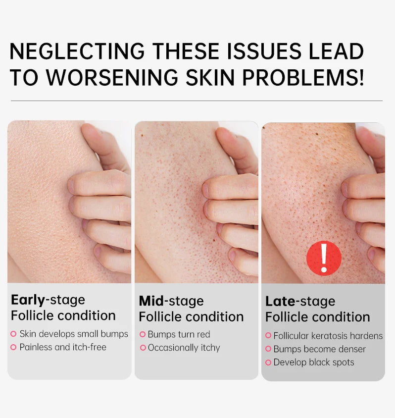 KP Repair Body Cream – Smooth & Moisturize